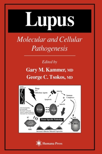 Lupus : Molecular and Cellular Pathogenesis, Hardback Book