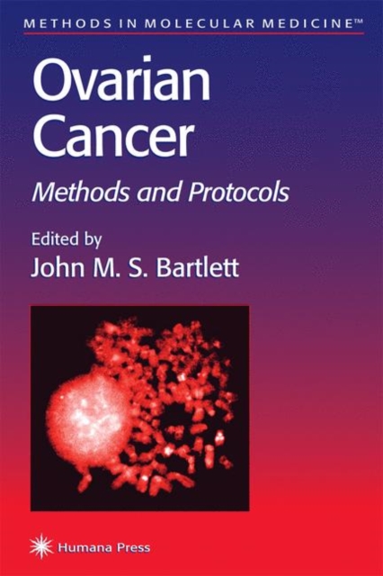 Ovarian Cancer : Methods and Protocols, Hardback Book