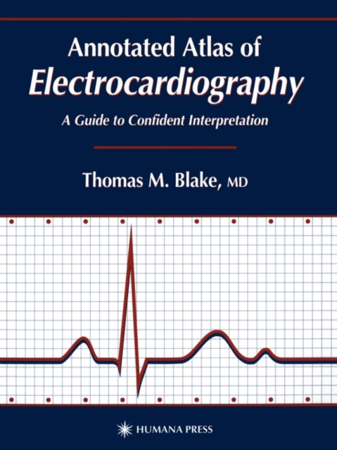 Annotated Atlas of Electrocardiography : A Guide to Confident Interpretation, Paperback / softback Book