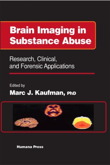 Brain Imaging in Substance Abuse : Research, Clinical, and Forensic Applications, Hardback Book
