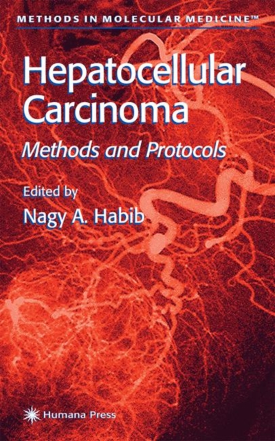 Hepatocellular Carcinoma : Methods and Protocols, Hardback Book