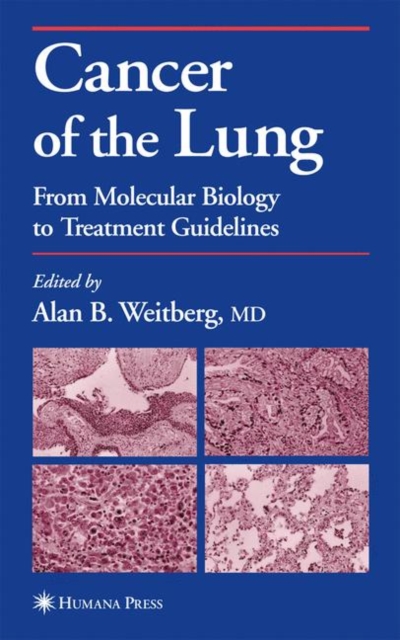 Cancer of the Lung : From Molecular Biology to Treatment Guidelines, Hardback Book