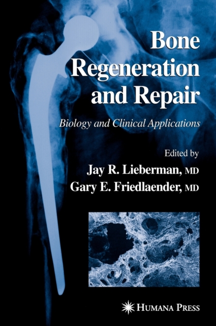 Bone Regeneration and Repair : Biology and Clinical Applications, Hardback Book