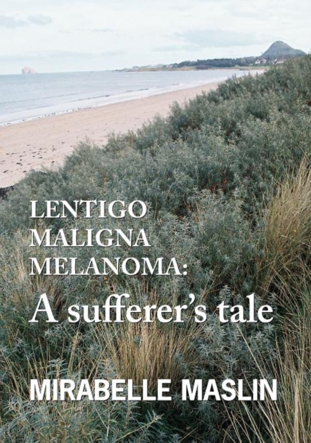 Lentigo Maligna Melanoma : A Sufferer's Tale, Paperback / softback Book