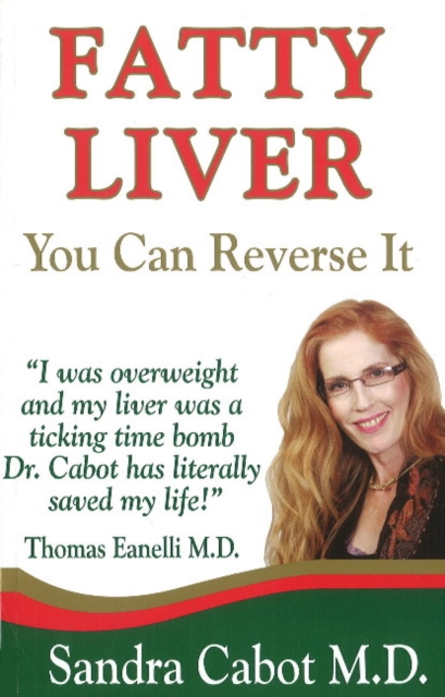 Fatty Liver : You Can Reverse It, Paperback / softback Book