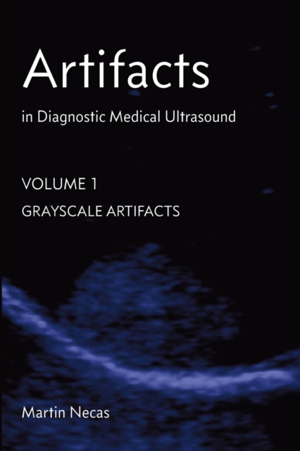 Artifacts in Diagnostic Medical Ultrasound : Grayscale Artifacts, Paperback / softback Book