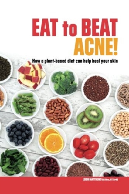 Eat to Beat Acne! : How a plant-based diet can help heal your skin., Paperback / softback Book