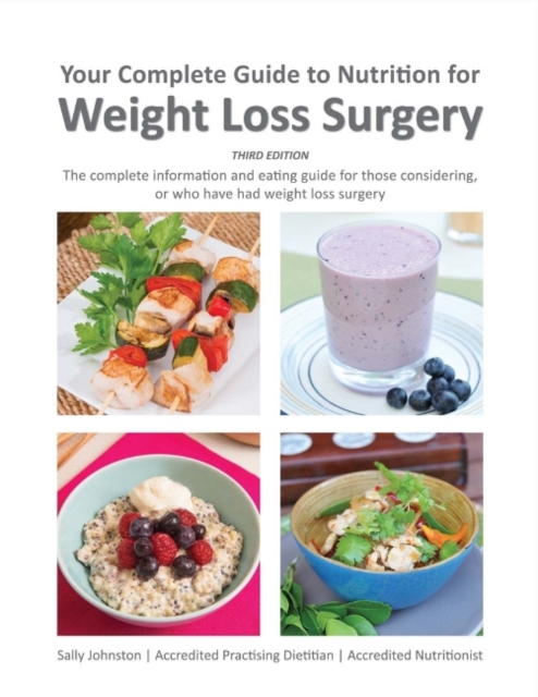 Your Complete Guide to Nutrition for Weight Loss Surgery, Paperback / softback Book