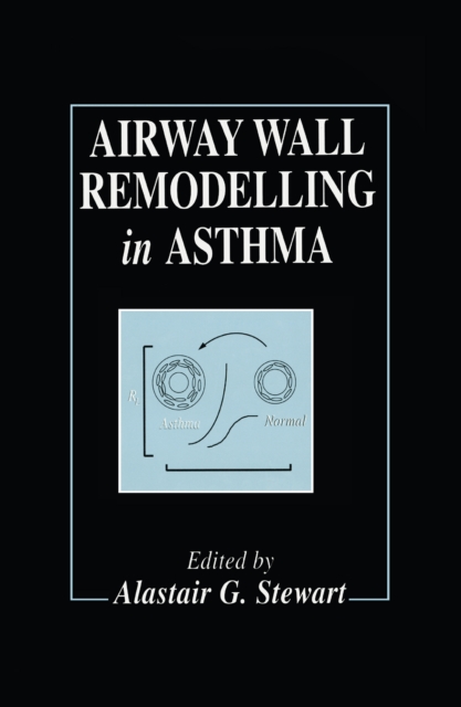 Airway Wall Remodelling in Asthma, PDF eBook
