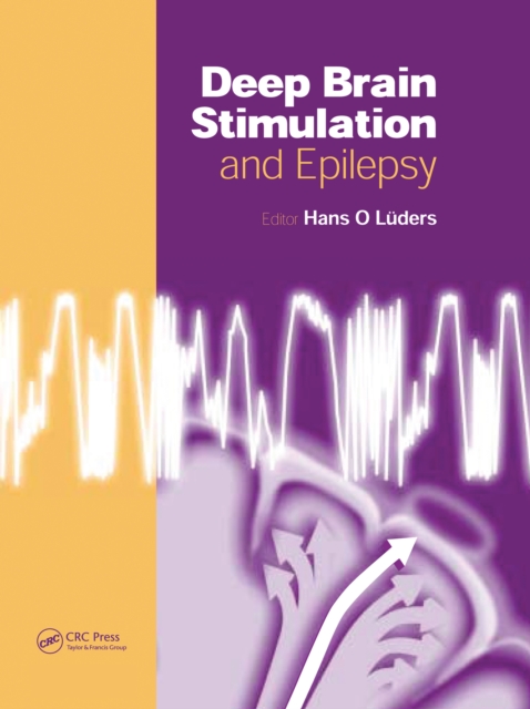 Deep Brain Stimulation and Epilepsy, PDF eBook