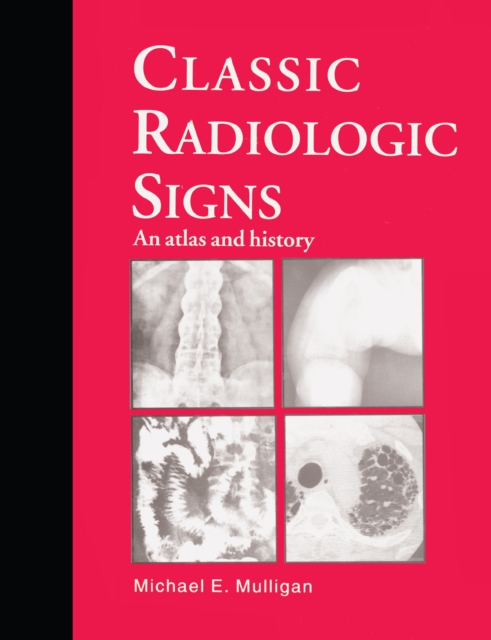 Classic Radiologic Signs : An Atlas and History, PDF eBook