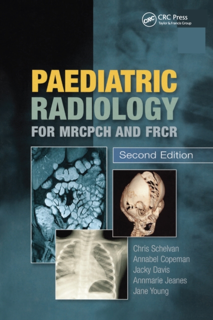 Paediatric Radiology for MRCPCH and FRCR, Second Edition, EPUB eBook
