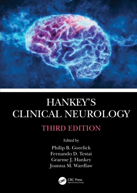 Hankey's Clinical Neurology, EPUB eBook