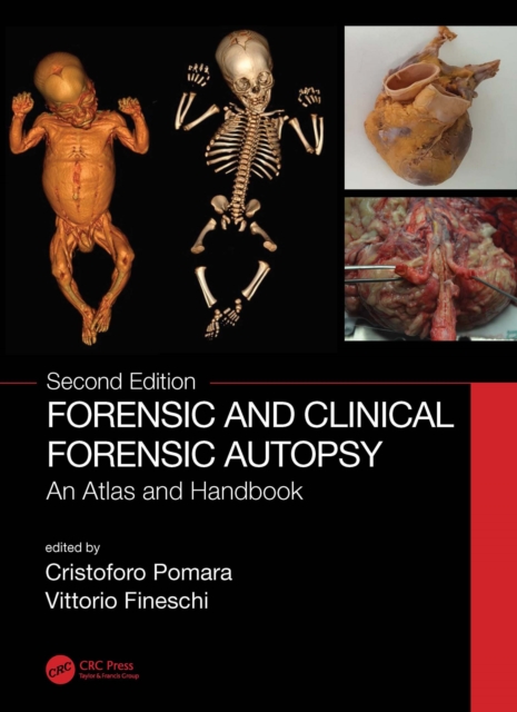 Forensic and Clinical Forensic Autopsy : An Atlas and Handbook, PDF eBook