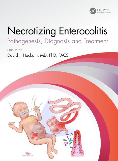Necrotizing Enterocolitis : pathogenesis, diagnosis and treatment, EPUB eBook