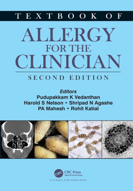 Textbook of Allergy for the Clinician, PDF eBook