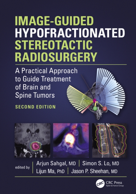 Image-Guided Hypofractionated Stereotactic Radiosurgery : A Practical Approach to Guide Treatment of Brain and Spine Tumors, EPUB eBook