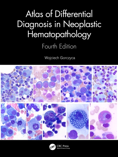 Atlas of Differential Diagnosis in Neoplastic Hematopathology, PDF eBook