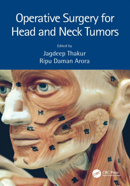 Operative Surgery for Head and Neck Tumors, PDF eBook