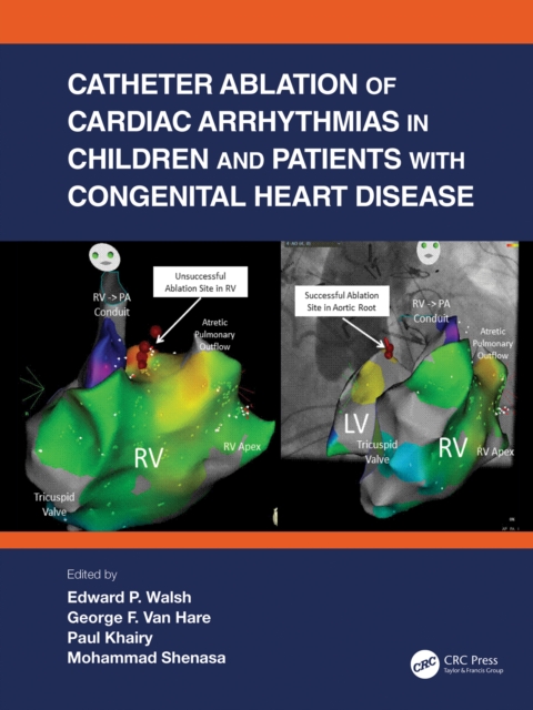 Catheter Ablation of Cardiac Arrhythmias in Children and Patients with Congenital Heart Disease, PDF eBook