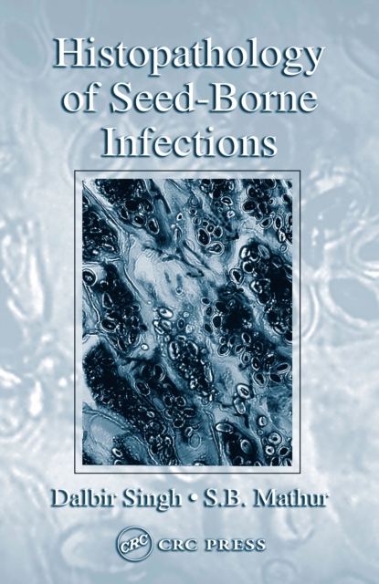 Histopathology of Seed-Borne Infections, EPUB eBook