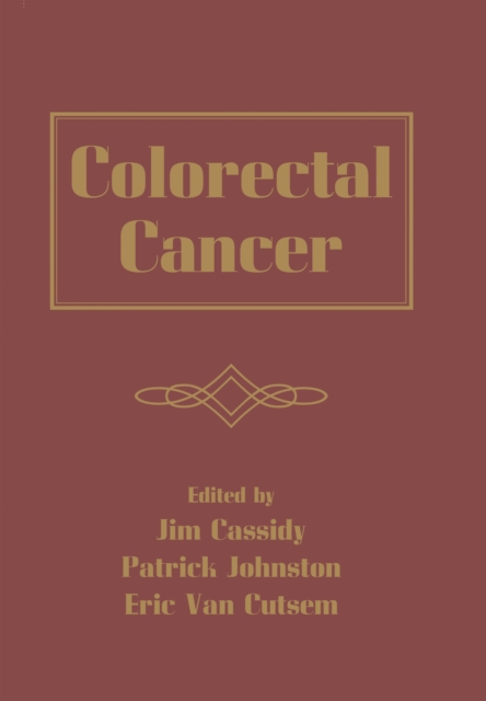 Colorectal Cancer, EPUB eBook
