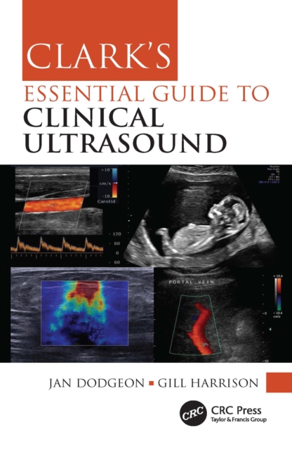 Clark's Essential Guide to Clinical Ultrasound, EPUB eBook