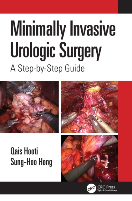 Minimally Invasive Urologic Surgery : A Step-by-Step Guide, EPUB eBook