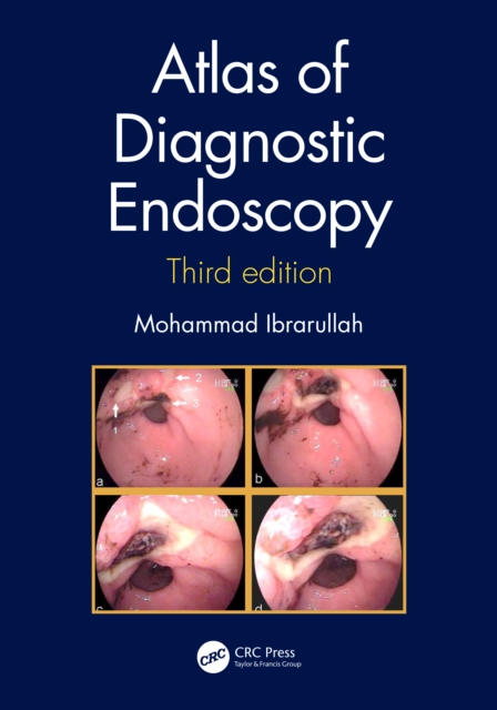 Atlas of Diagnostic Endoscopy, 3E, EPUB eBook