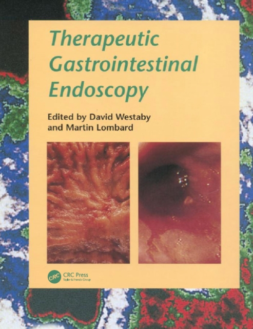 Therapeutic Gastrointestinal Endoscopy, EPUB eBook