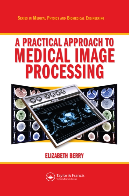 A Practical Approach to Medical Image Processing, EPUB eBook