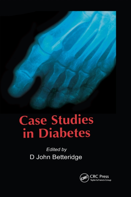 Case Studies in Diabetes, EPUB eBook