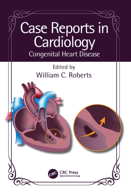 Case Reports in Cardiology : Congenital Heart Disease, PDF eBook