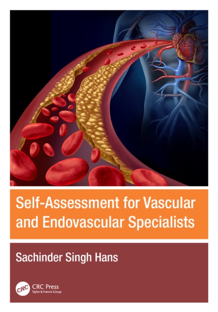 Self-Assessment for Vascular and Endovascular Specialists, PDF eBook