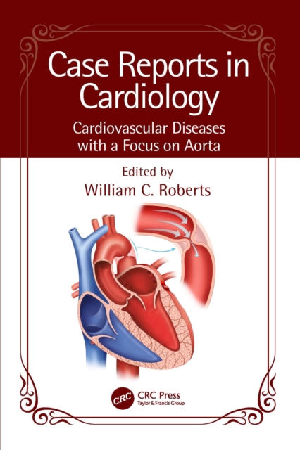 Case Reports in Cardiology : Cardiovascular Diseases with a Focus on Aorta, EPUB eBook