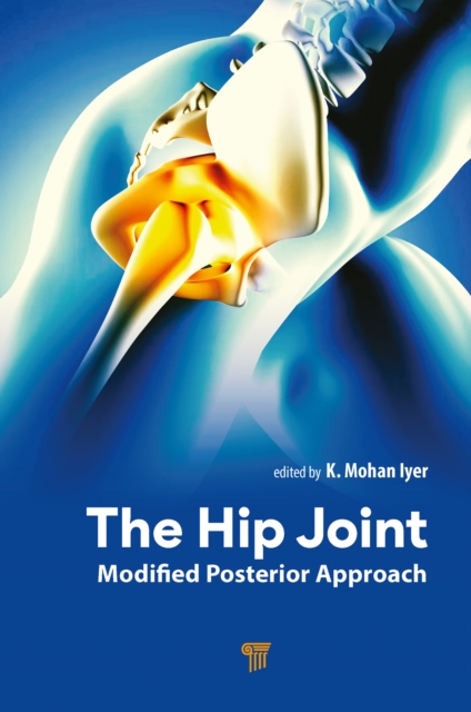 The Hip Joint : Modified Posterior Approach, PDF eBook