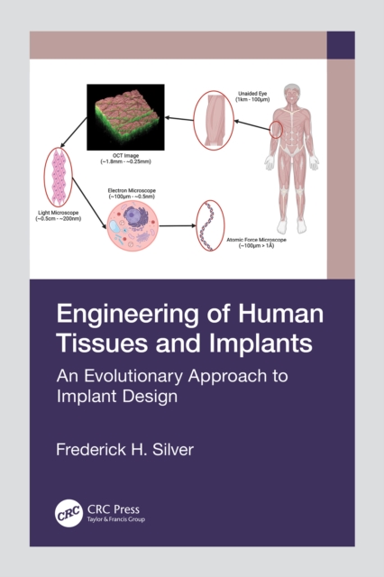 Engineering of Human Tissues and Implants : An Evolutionary Approach to Implant Design, PDF eBook