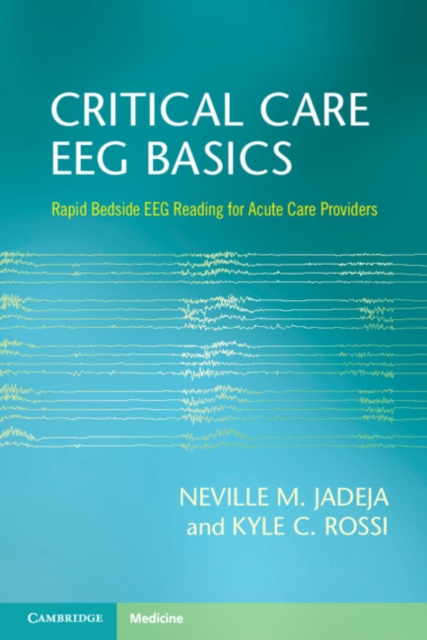 Critical Care EEG Basics : Rapid Bedside EEG Reading for Acute Care Providers, Paperback / softback Book