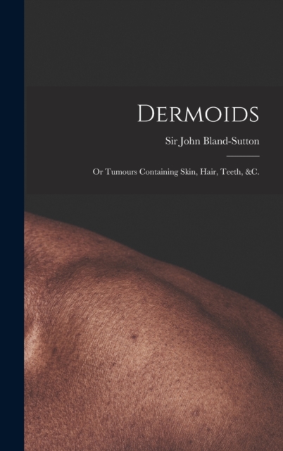 Dermoids : or Tumours Containing Skin, Hair, Teeth, &c., Hardback Book