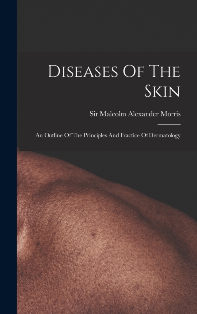 Diseases Of The Skin : An Outline Of The Principles And Practice Of Dermatology, Hardback Book