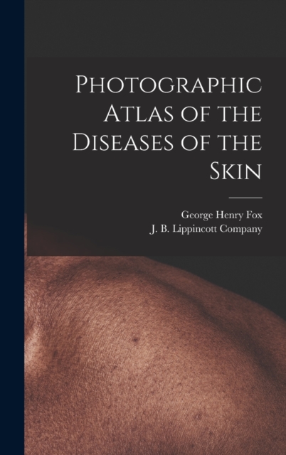 Photographic Atlas of the Diseases of the Skin, Hardback Book