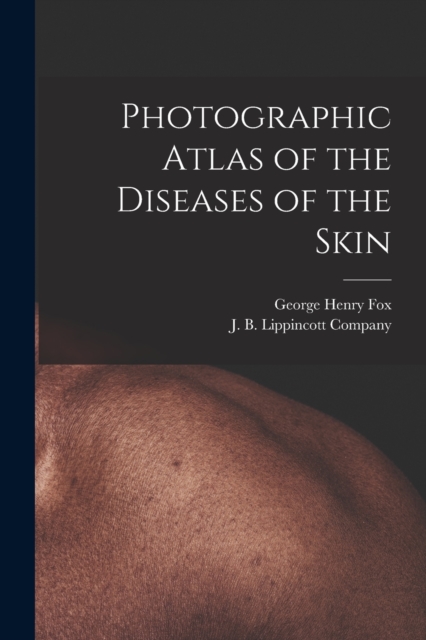 Photographic Atlas of the Diseases of the Skin, Paperback / softback Book