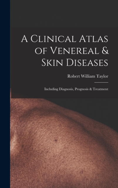 A Clinical Atlas of Venereal & Skin Diseases : Including Diagnosis, Prognosis & Treatment, Hardback Book