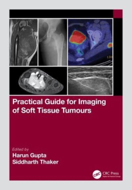 Practical Guide for Imaging of Soft Tissue Tumours, Paperback / softback Book