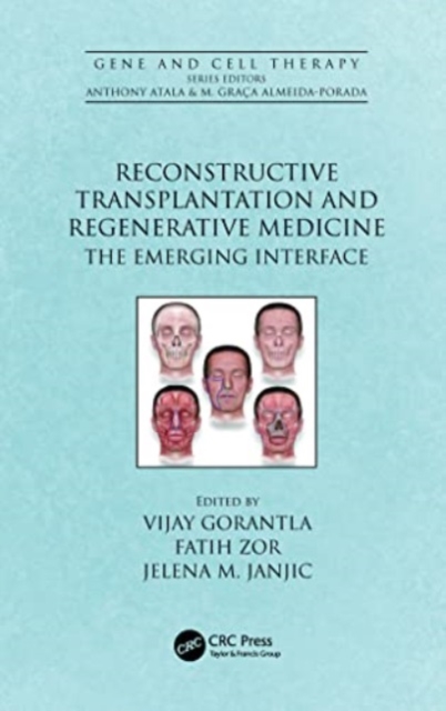 Reconstructive Transplantation and Regenerative Medicine : The Emerging Interface, Paperback / softback Book