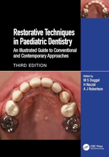 Restorative Techniques in Paediatric Dentistry : An Illustrated Guide to Conventional and Contemporary Approaches, Hardback Book