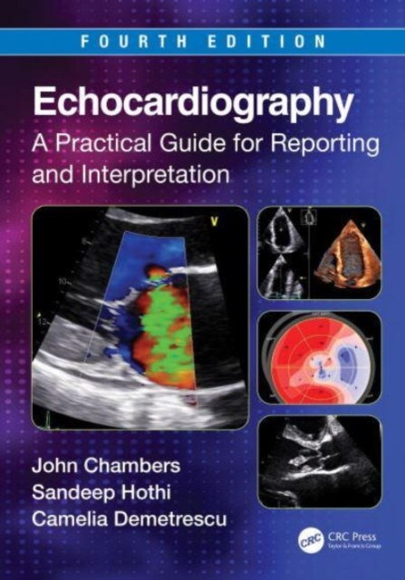 Echocardiography : A Practical Guide for Reporting and Interpretation, Paperback / softback Book