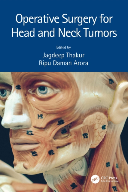 Operative Surgery for Head and Neck Tumors, Paperback / softback Book