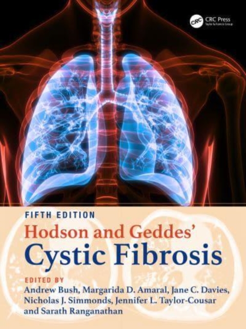 Hodson and Geddes' Cystic Fibrosis, Hardback Book