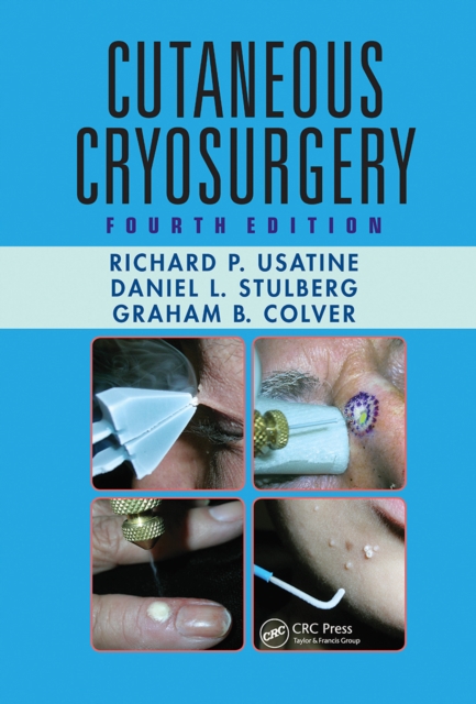 Cutaneous Cryosurgery, Paperback / softback Book